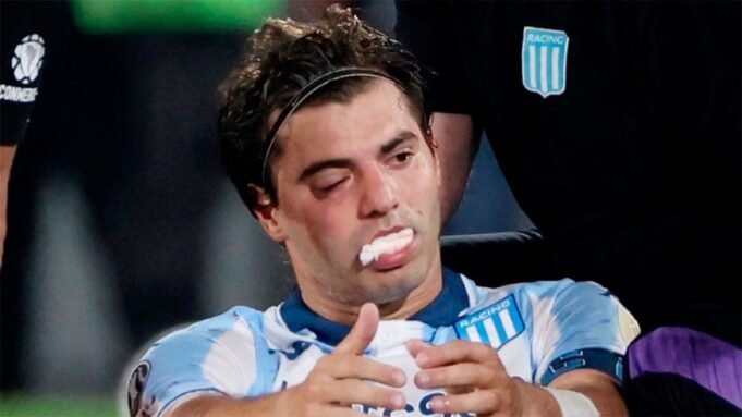 santiago-sosa-racing-lesion-532963-100233.jpg