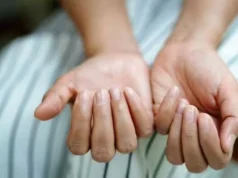 不要忽視你的指甲。顏色的變化可以揭示危及生命的疾病 – 沙特新聞