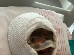 一名土耳其男子將妻子綁起來,並向她潑“酸”,抹掉了她的容貌……因為她要求離婚 – 沙特新聞