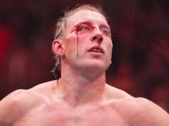 Dana White 在 UFC 324 比賽后分享了住院的 Paddy Pimblett 的最新情況