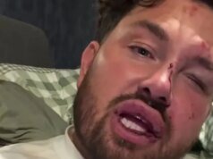 這位《一見鍾情》的明星在襲擊後崩潰了,她的眼睛青腫,有割傷和瘀傷。