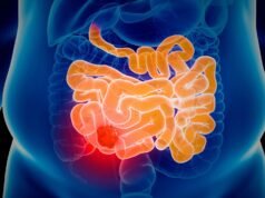 新開發的 NHS 腸癌檢測仍然快速、簡單,並且可以在家完成