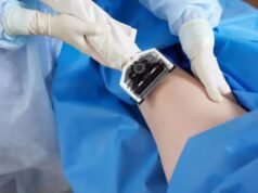 SCTIMST 開發組織移植物以加速傷口癒合,ETHealthworld