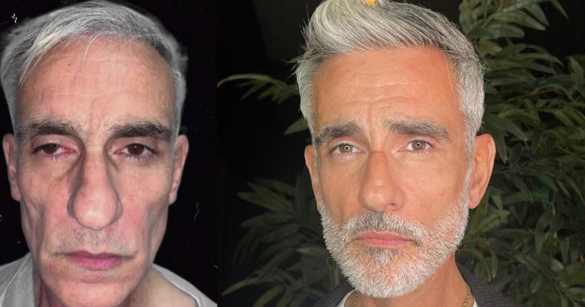 米格爾·法拉奧內 (Miguel Faraone) 重返社交網絡“年輕了 20 歲”，得益於這種審美上的“最後一筆” – Publimetro Columbia