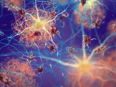 科學家發現了消除阿茲海默症斑塊的大腦開關