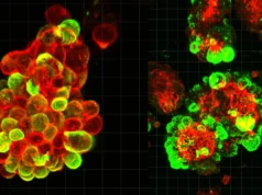 秘密細胞聯盟可能解釋為什麼卵巢癌如此危險