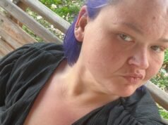 1000 磅。艾米·斯萊頓姊妹在婚後手術中拒絕使用假睫毛