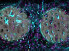 雷射列印的水凝膠植入物可以改變骨修復過程