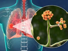 這種簡單的血液蛋白可以阻止致命的黑木耳