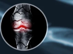 科學家創造了一種軟骨支架,可以幫助身體再生骨骼