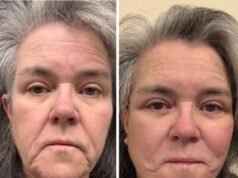 64 歲的羅西·奧唐納 (Rosie O’Donnell) 分享了在無人注意的情況下多付購車費用後整容的令人震驚的照片