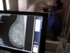 SUS 將包括乳癌基因檢測;了解更多