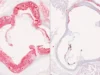 科學家發現肝臟降低有害膽固醇的隱藏關鍵