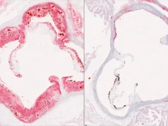 科學家發現肝臟降低有害膽固醇的隱藏關鍵
