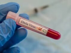 剛果東部伊波拉疫情爆發:死亡人數上升至 131 人,緊急擔憂,ETHealthworld