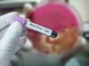 剛果民主共和國伊波拉疫情導致死亡人數上升:ETHealthworld 認為面臨風險的國家