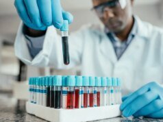 研究發現測量生物年齡的血液檢查可以預測癡呆症風險