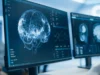 科學家認為腦炎導致了新冠病毒的長期傳播,但掃描結果卻顯示出不同的情況