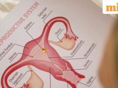 PCOS 將被稱為 PMOS,因為專家表示舊名稱會導致混亂和護理延誤