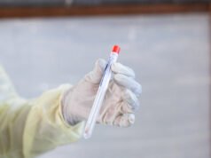 科學家被指控密謀將 Mpox 病毒走私到美國