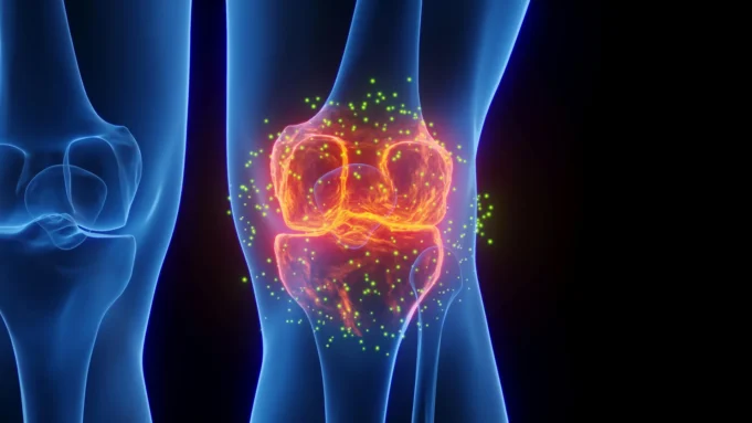 3d-knee-joint-inflammation-osteoarthritis.webp