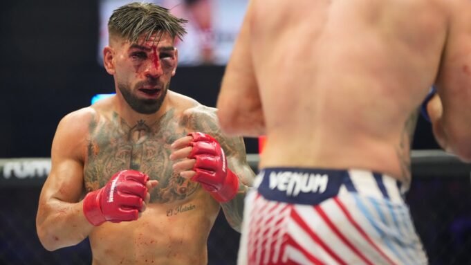 Ilia-Toupruia-bloody-at-UFC-Freedom-250.jpg