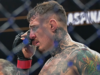 UFC內部人士質疑湯姆·阿斯皮諾爾的傷病恢復時間:“發生了一些奇怪的事情”