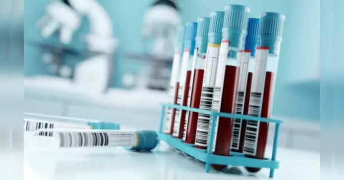 blood-test-can-predict-lung-cancer-5-years-before-diagnosis.jpg