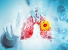 主要審查發現電子煙可能導致肺癌和口腔癌
