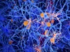 科學家重新編程大腦中的免疫細胞來對抗阿茲海默症