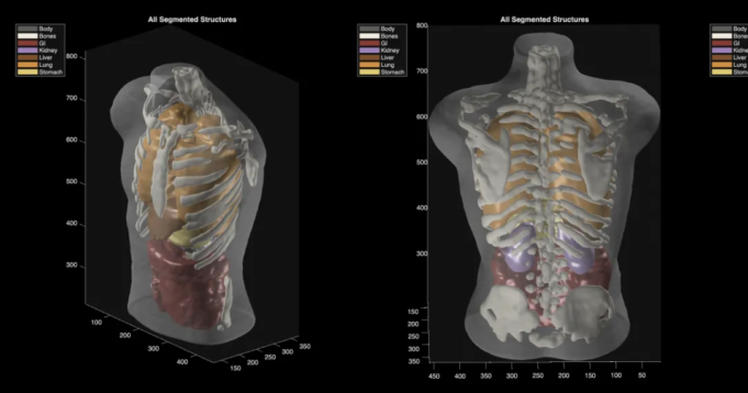 ultrasound_phantom_segmentation-b254a71d083eb5c9.png